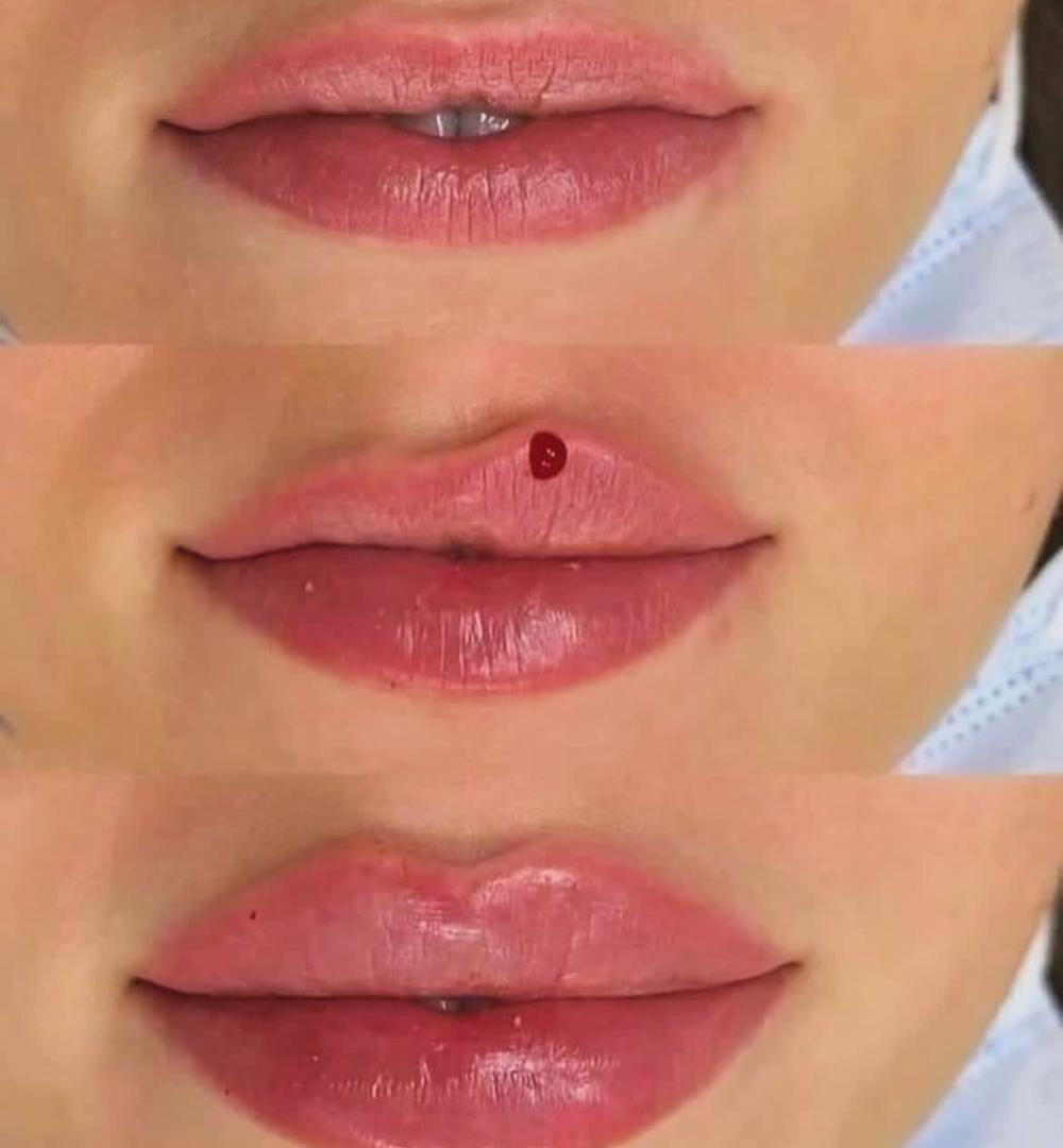 خدمات ژل لب