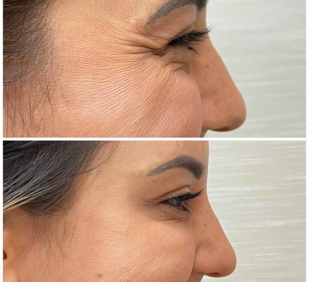 انواع خدمات کلینیک زیبایی رخ آرا در کرج