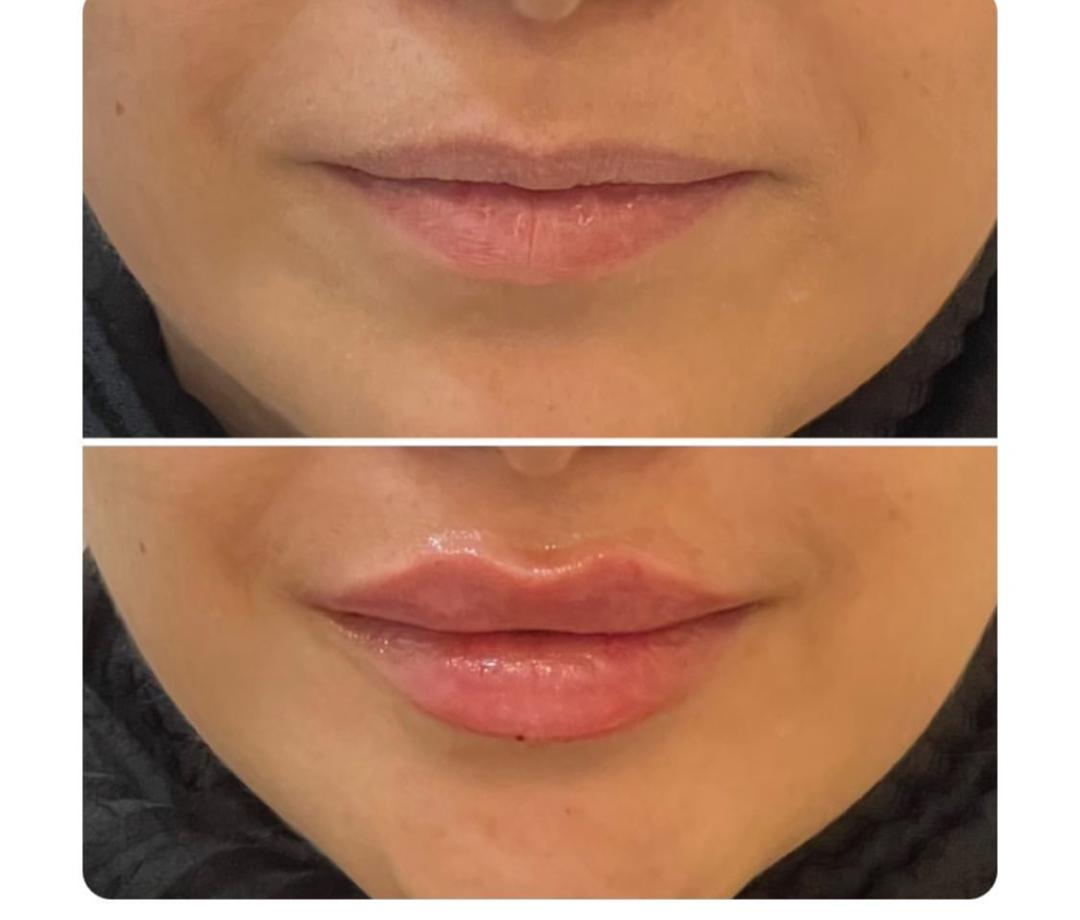 اهمیت انتخاب کلینیک زیبایی معتبر